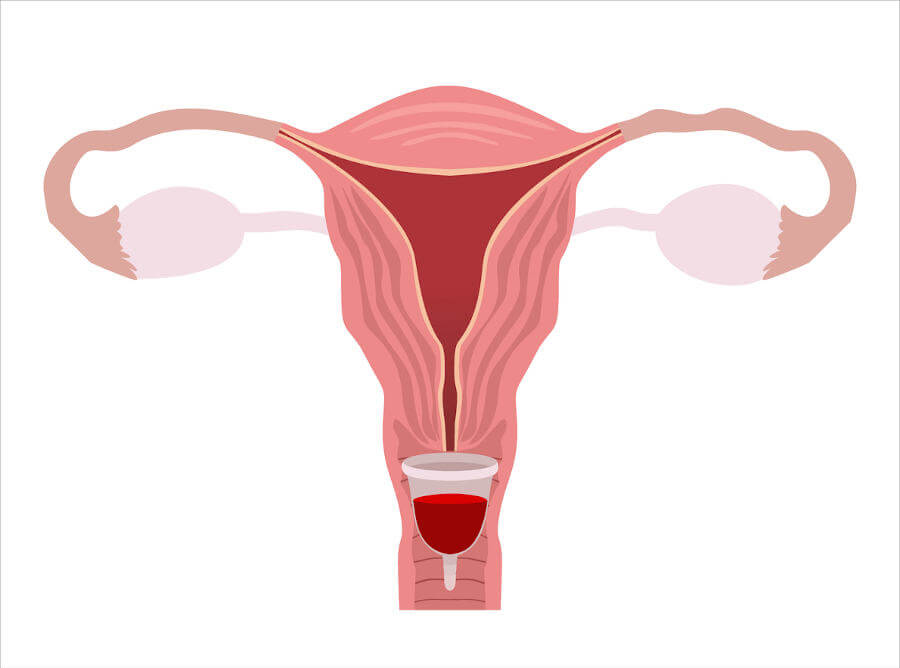 Die richtige Position der Menstruationstasse: oben an der Scheidewand (unter dem Muttermund) und etwa ein bis zwei Zentimeter hinter dem Scheideneingang. 