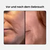 A split image showing a close-up of a person's face before and after using a product, highlighting the reduction of wrinkles. Produktbild-Vorschau