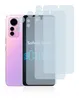 6x Für Xiaomi 12 Lite (Display+Kamera) Schutzfolie Savvies Produktbild-Vorschau 2