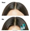 L´Oréal Professionnel Scalp Advanced Anti-Discomfort Náhľad obrázku produktu 4