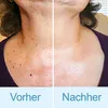 A split image showing a before and after of a person's neck and décolletage, with text labels 'Vorher' (Before) and 'Nachher' (After). Produktbild-Vorschau