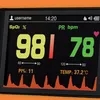 GIMA OXY-110 Digitales Pulsoximeter: genaue Überwachung der Produktbild-Vorschau 4