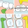 20-Pack TePe Interdentalbürste Angle Pink, ISO-Größe 0, Produktbild-Vorschau 7
