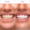 Hismile V34 Whitening Strips, Teeth Whitening Strips, Produktbild-Vorschau 6