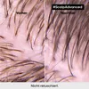 L'Oreal Serie Expert Scalp Advanced Professional Shampoo Produktbild-Vorschau 4