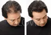 A side-by-side comparison showing a man's hair before and after using hair fibers. Podgląd zdjęcia produktu