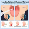 Mandelstein Entferner, Tonsillenstein Entferner​, 3 Produktbild-Vorschau 2
