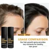 2stk Haarwachstumsspray, 50 ml, natürlicher, Produktbild-Vorschau 11