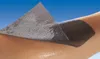 ATRAUMAN Ag 10x10 cm steril Kompressen Produktbild-Vorschau 8