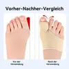 Hallux Valgus Korrektor 2 Paar mit Gelpolster, Produktbild-Vorschau 4