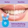 Szczoteczka soniczna VITALmaxx 360° z niebieskim światłem Podgląd zdjęcia produktu 4