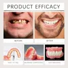 Volledige Dentuurset - Natuurlijk uitziende siliconen Productafbeelding-voorbeeld 4