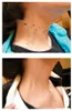 A collage of two images showing a person's neck and upper chest, with the top image showing numerous moles and the bottom image showing clear skin. Produktbild-Vorschau