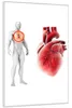 Wallario Wandbild Anatomie des Menschen  Herz in Produktbild-Vorschau 2