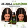 Ricinusolie Shampoo met Biotine voor Sterker en Groeiend Productafbeelding-voorbeeld 4