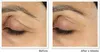 RoC Retinol Correxion®️ Line Smoothing Eye Cream 15 ml Náhľad obrázku produktu 8