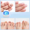Nagelpilz Laser Behandlungsgerät, Nagelpilz Behandlung für Produktbild-Vorschau 12