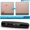 Penna BiteHelper Guaritore elettronico per punture di Anteprima dell’immagine prodotto 5