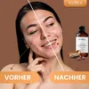 Rizinusöl, ätherisches Öl, 100% Rein, BIO, natürlich, 100 Produktbild-Vorschau 3