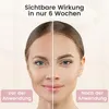 5-in-1 EMS Mikrostrom Gesichtsmassagegerät zur Straffung Produktbild-Vorschau 5