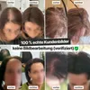 Collage of before and after images showing hair thickening results, with text overlays indicating "before" and "after" and promotional text. Anteprima dell’immagine prodotto