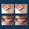 Kit per la riparazione temporanea dei denti EELHOE per Anteprima dell’immagine prodotto 8