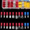 280ks sada káblových objímok so sortimentnou krabicou Sada Náhľad obrázku produktu 11