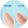 Scholl Velvet Smooth Elektronisches Nagelpflegesystem Produktbild-Vorschau 4