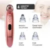 Odstraňovač černých teček a vysavač pórů s kamerou, čistič Náhled obrázku produktu 4