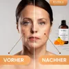 Calendula-Öl, Kaltgepresst, 100% Rein, BIO, natürlich, 30 Produktbild-Vorschau 3
