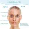 Ice Roller Gesichtsroller, Dual Kopf, Kühlend Massagegerät, Produktbild-Vorschau 4