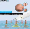 An advertisement for a skin cleansing device, showing a close-up of a nose with blackheads and a magnified view of pores, alongside an illustration of the device cleaning skin. Produktbild-Vorschau