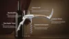 RADOLEO® Kellnermesser GMELIA - Korkenzieher, Weinöffner | Profi Sommeliermesser, Flaschenöffner Produktbild-Vorschau