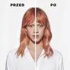 A split image showing a person's face and hair, with text indicating 'Before' and 'After'. Anteprima dell’immagine prodotto
