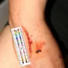 Selbstklebende Aufkleber mit Wundmesswerkzeugen, 100 Stück, Produktbild-Vorschau 3