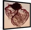 MuchoWow® Gerahmtes Poster Anatomisches Herz 60x80 cm - Produktbild-Vorschau 1