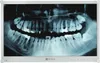 A medical monitor displaying a dental X-ray. Produktbild-Vorschau