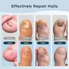 Appareil laser contre les mycoses des ongles, appareil de Voir les images du produit 4