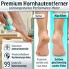 Grundig Hornhautentferner elektrisch Pro - schnell Hornhaut Produktbild-Vorschau 4