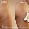 Elektrisches Gua Sha Körpermassagegerät mit Wärme und EMS Produktbild-Vorschau 3