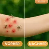 Insektenschutz, zum Schutz vor Mücken, 100% Rein, BIO, Produktbild-Vorschau 3
