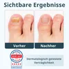 MALUFIN® Nagelbalsam Spray – Tiefenpflege der Nagelmatrix | Produktbild-Vorschau 4