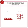 SCHEPPACH EGT350 SET Elektro Rasentrimmer Freischneider Produktbild-Vorschau 2