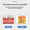 Kopfmassagegeräte, elektrisches Kopfmassagegerät, Kopfhaut Produktbild-Vorschau 9