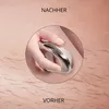 A hand holding a silver hair removal device over skin with hair, with 'NACHHER' (after) and 'VORHER' (before) text. Produktbild-Vorschau