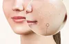 Anlan Firming facial device ANLAN 01-AVLY41-02A Anteprima dell’immagine prodotto 6