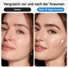 Schröpfmassagegerät, Anti Cellulite Massagegerät Produktbild-Vorschau 3