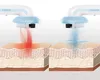 Massaggiatore Anticellulite a Cavitazione Ultrasonica con Anteprima dell’immagine prodotto 6