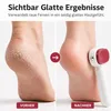 2-in-1 Fußfeile doppelseitig, professioneller Produktbild-Vorschau 5