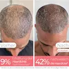 Brosse à cheveux à lumière rouge STYLPRO - LED Scalp Voir les images du produit 4